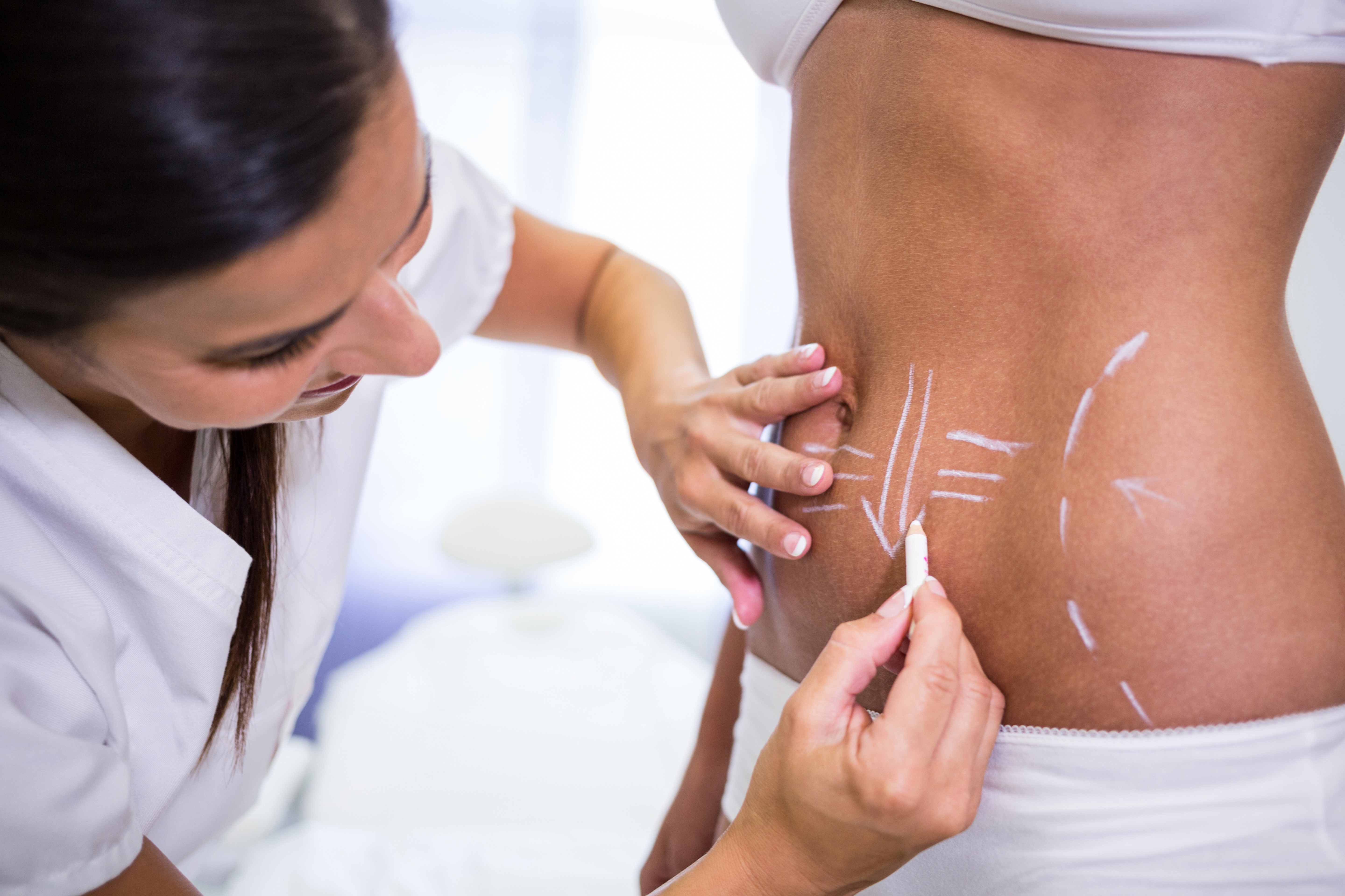 Stretch Mark Reduction Treatment in Wagholi Pune by Dr Vandana Sharma